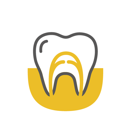 歯の神経温存治療