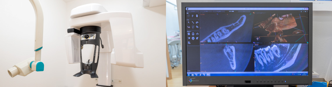 最新のCTスキャン